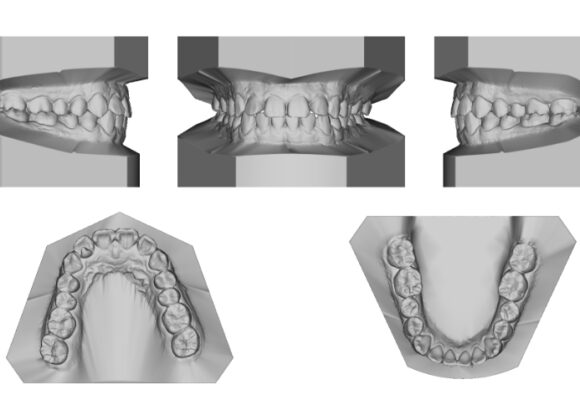 Guías Quirúrgicas Studio Digital Imaging
