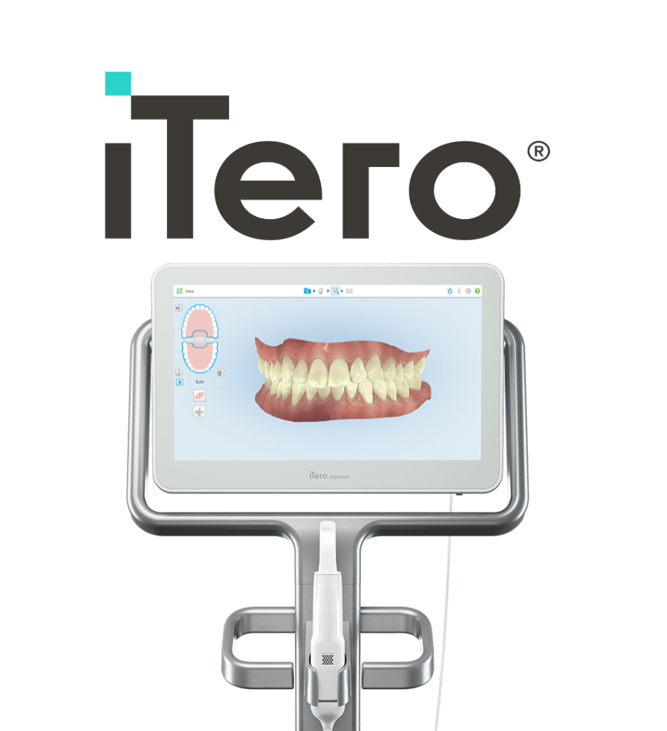 Escaner dental digital iTero en Studio Digital Imaging