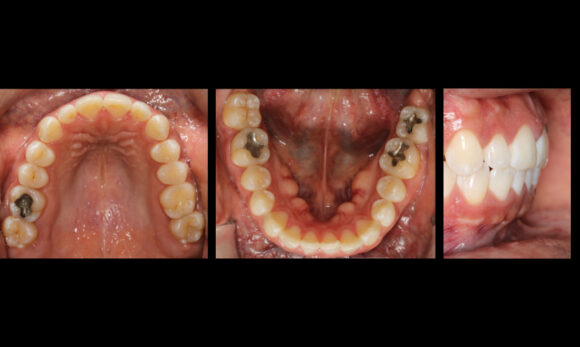 Fotografía intraoral