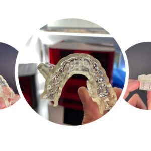 Guías quirúrgicas 3D en Studio Digital Imaging