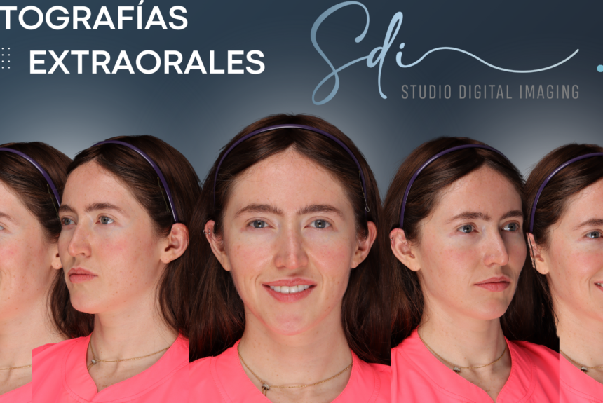 3 Las fotografías extraorales e intraorales en Studio Digital Imaging