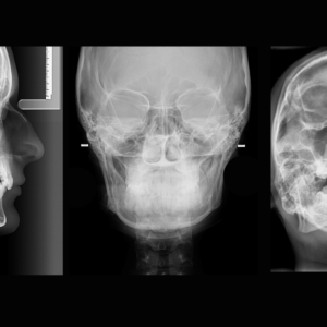 RX de Senos Paranasales 3 Proyecciones en Studio Digital Imaging