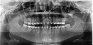 Radiografía Panorámica Un Servicio Especializado en STUDIO DIGITAL IMAGING