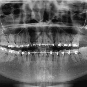 Radiografía Panorámica Un Servicio Especializado en STUDIO DIGITAL IMAGING