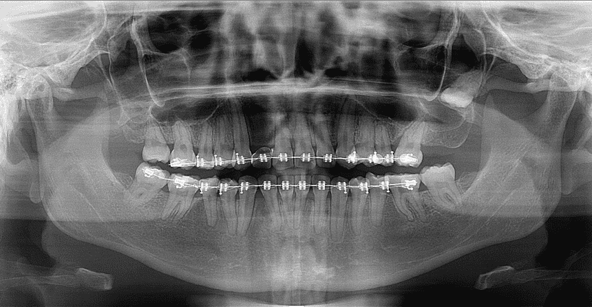Radiografía Panorámica Un Servicio Especializado en STUDIO DIGITAL IMAGING