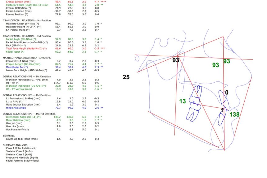 SVA Análisis De Ricketts En Studio Digital Imaging