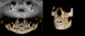 Tomografia-Dental-Completa-en-Studio-Digital-Imaging