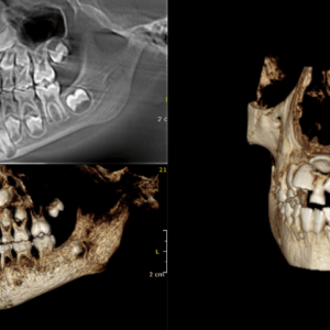 Tomografía Dental Completa en Studio Digital Imaging Tomografia-Dental-Completa-en-Studio-Digital-Imaging