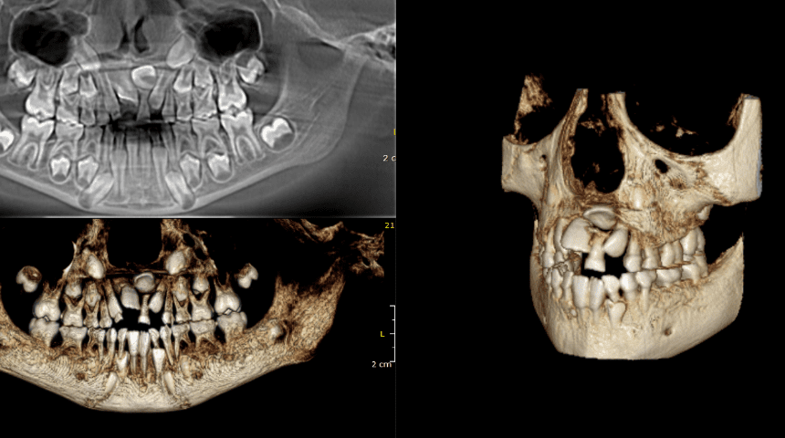 Tomografia-Dental-Completa-en-Studio-Digital-Imaging