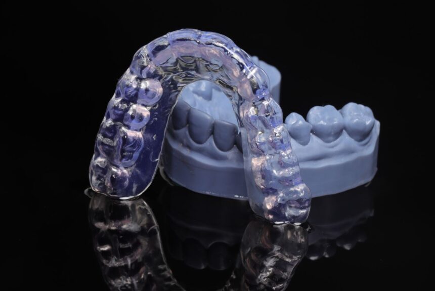 ¿Qué es la guarda oclusal y para qué sirve?