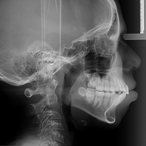 Radiografía Lateral de Cráneo en Studio Digital Imaging